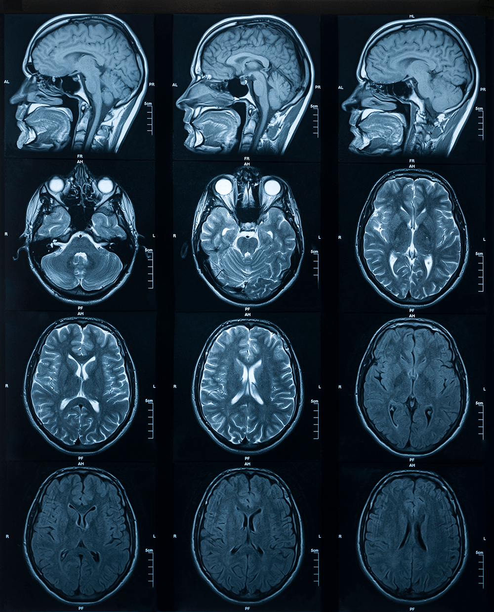 iStock-1206602178-min.png